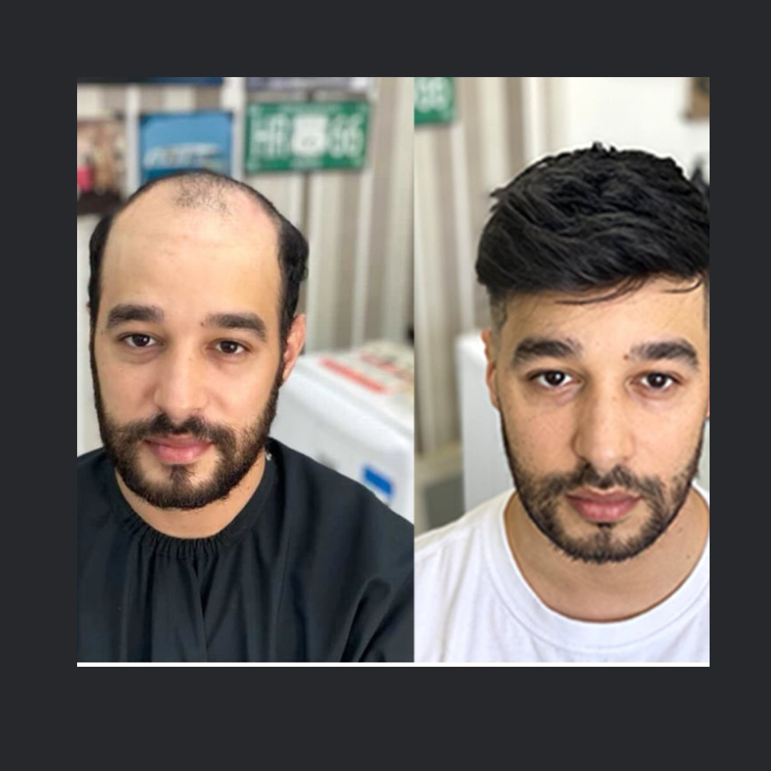 Perruques homme