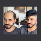 Perruques homme
